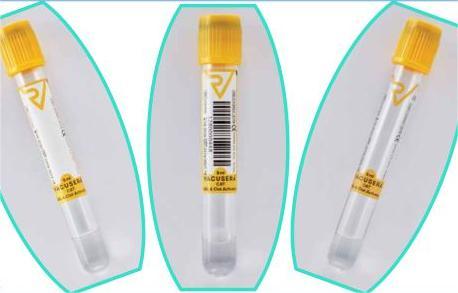 لوله PRP و سانتریفیوژ پی آر پی – خرید، قیمت و معرفی تجهیزات آماده‌سازی PRP